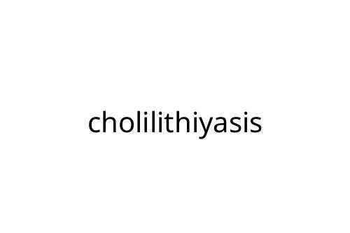 cholilithiyasis